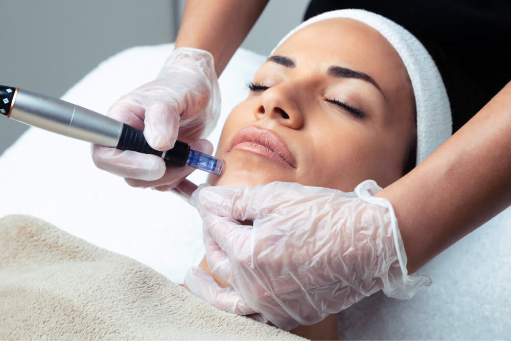 How To Care For Your Skin Before And After Microneedling